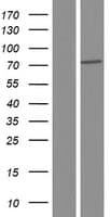 TGM5 / Transglutaminase 5 Protein (Over-Expression Lysate Myc-DDK (Flag))