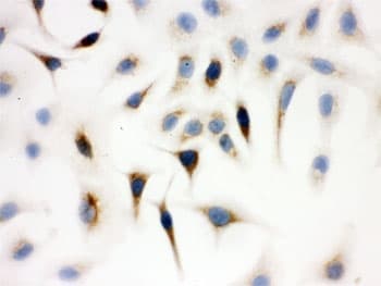 WAS / WASP Antibody