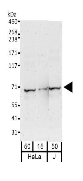 IGF2BP2 Antibody (clone 3A3.5F1)