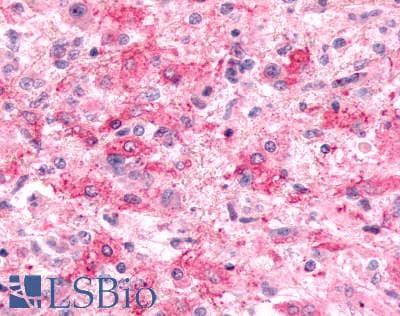 PathPlus™ Polyclonal Rabbit anti-Human ADGRE2 / EMR2 Antibody (N-Terminus, IHC)