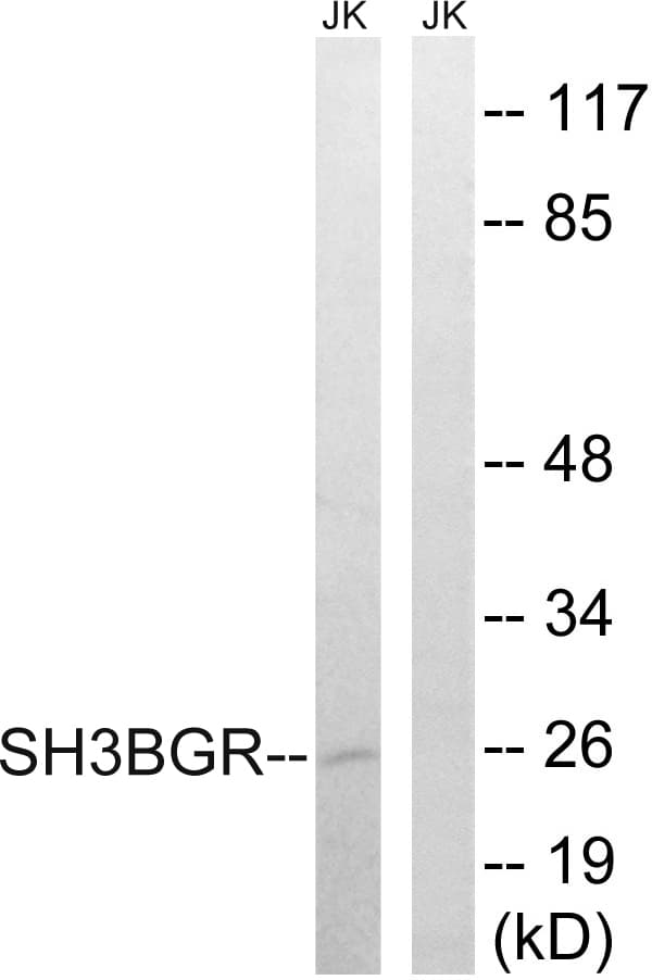 IHC-plus™ SH3BGR Antibody (aa81-130)