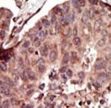 PKLR Antibody (aa521-551)