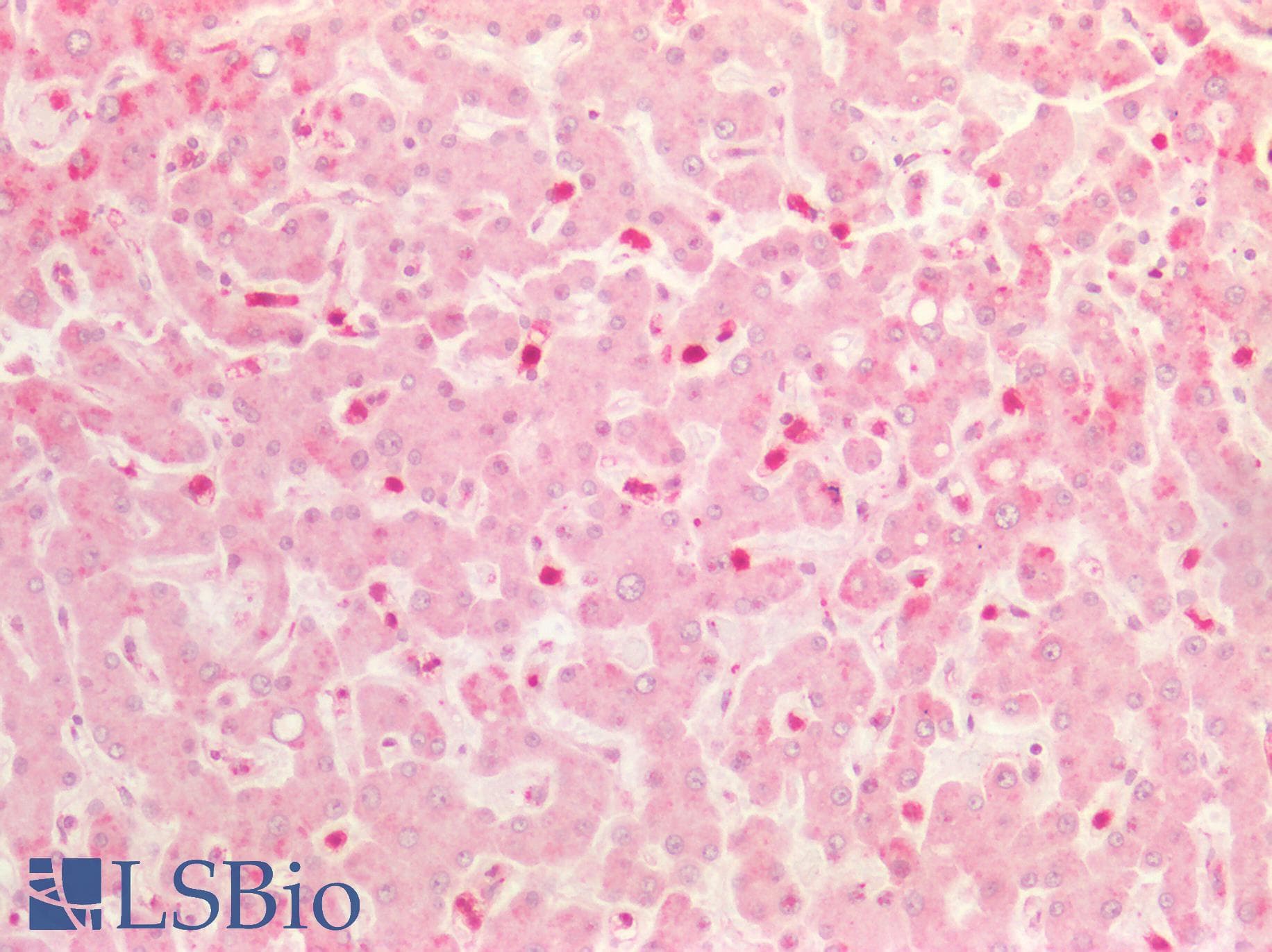 PathPlus™ EIF4EBP1 / 4EBP1 Antibody (aa35-84)