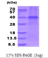 Human WNT3A Protein (Recombinant)