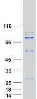Human KLHL22 Protein (Recombinant Myc-DDK (Flag))