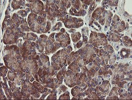 UBE2J1 Antibody (clone OTI1F6)