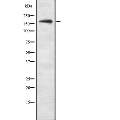 Polyclonal Rabbit anti-Human SCOP / PHLPP Antibody (WB)