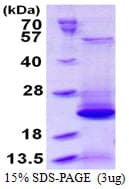 Human BLOC1S2 Protein (Recombinant His)