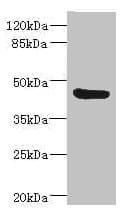 Polyclonal Rabbit anti-Human BAAT / BAT Antibody (IHC, WB)