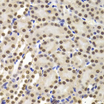 PPP1R8 / Rnase E Antibody