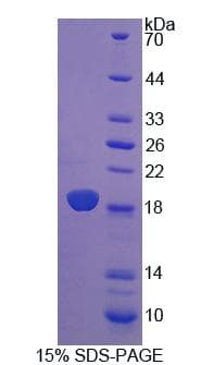 Human CRABP2 Protein (Recombinant His-T7)