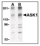 IHC-plus™ MAP3K5 / ASK1 Antibody