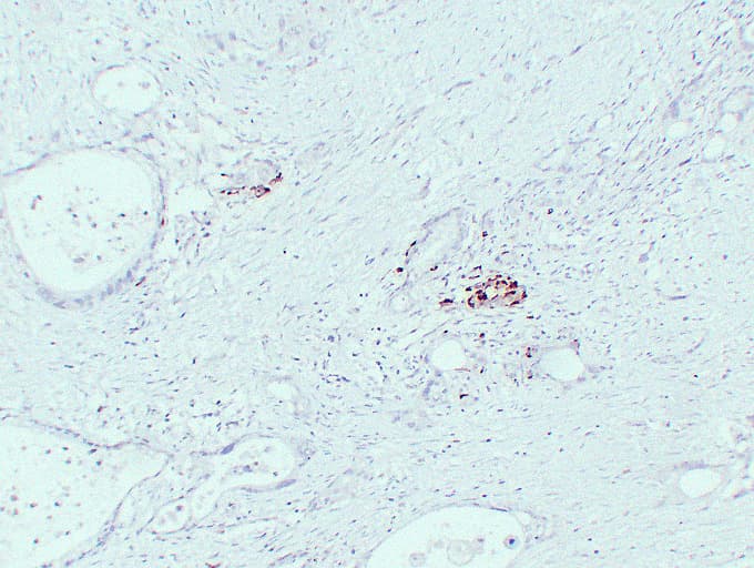 IGF2 Antibody (clone ABT-IGF2)