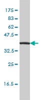Monoclonal Mouse anti-Human IL11RA Antibody (clone 2D4-F4, WB)