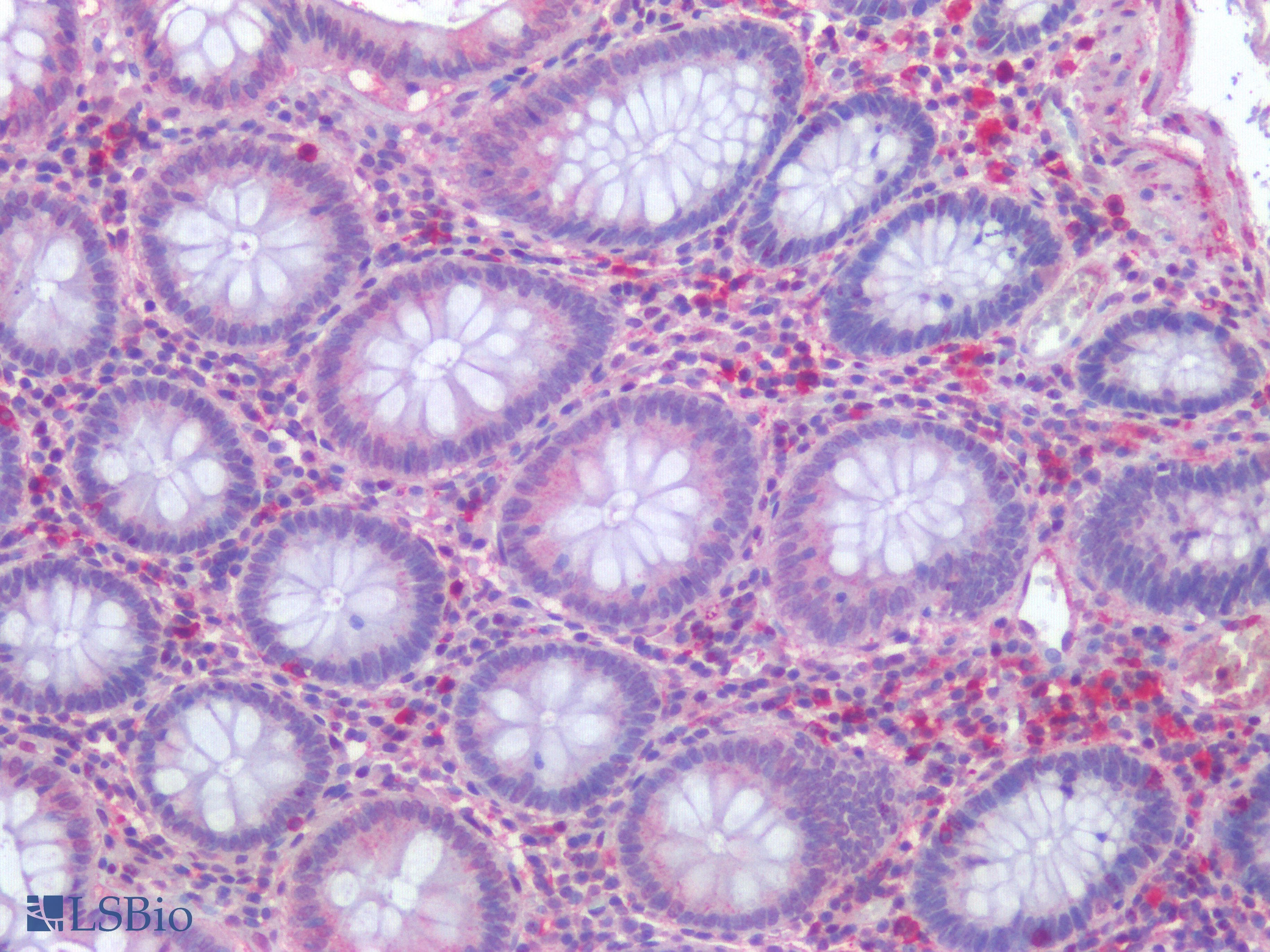 PathPlus™ HAVCR1 / KIM-1 Antibody