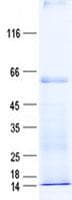 Human TBCCD1 Protein (Recombinant His, N-Terminal)