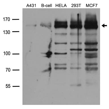 FANCI Antibody