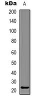 HSPB8 / H11 / HSP22 Antibody
