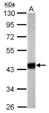 IHC-plus™ PDHA1 / PDH E1 Alpha Antibody (aa39-325)