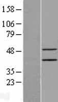 Human EPSTI1 Protein (Over-Expression Lysate Myc-DDK (Flag))