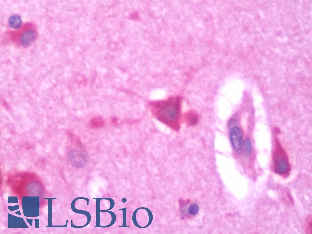 IHC-plus™ UBE2G2 Antibody (clone 4D6)