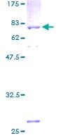 Human IGSF11 / VSIG3 Protein (Recombinant GST)