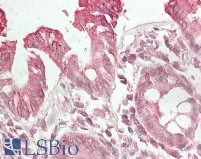 IHC-plus™ RCHY1 / PIRH2 Antibody