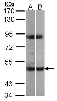 MAPKAPK5 / PRAK Antibody (aa197-457)
