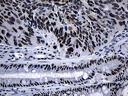 SUPT16H / FACTP140 Antibody (aa187-282, clone OTI8A1)