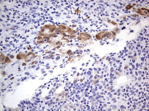 MAdCAM-1 Antibody (clone UMAB158)