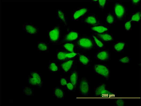 CAMK2A / CaMKII Alpha Antibody (clone 2C4)
