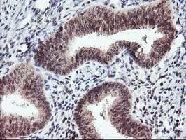 TP53 / p53 Antibody (clone OTI2H6, Carrier-free)
