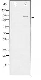 FGFR1 / FGF Receptor 1 Antibody
