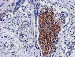 EXOSC7 Antibody (clone OTI1F4)