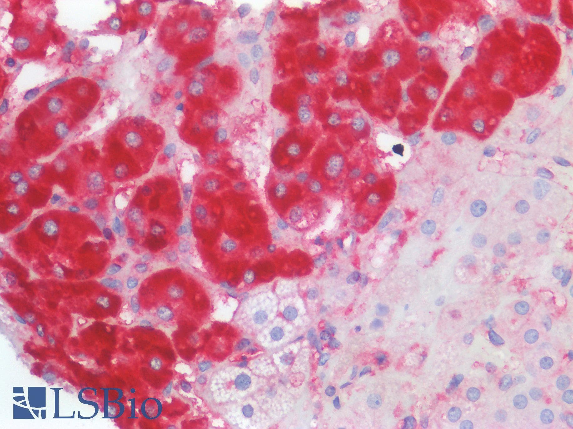 PathPlus™ B2M / Beta 2 Microglobulin Antibody (aa21-119, clone OTI1A7)