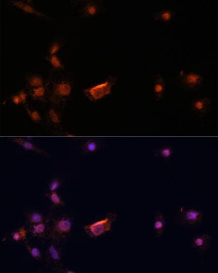 BRCA2 Antibody