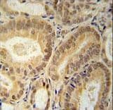 RBM24 Antibody (aa4-32)