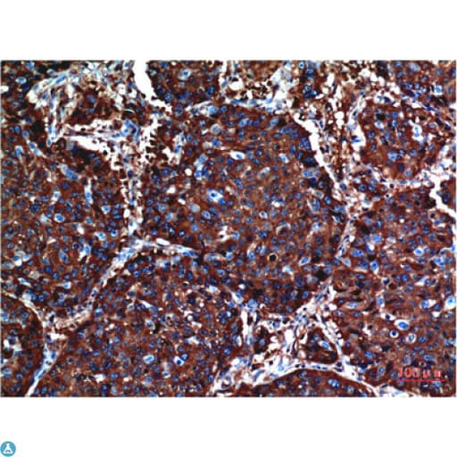 AKT1 Antibody