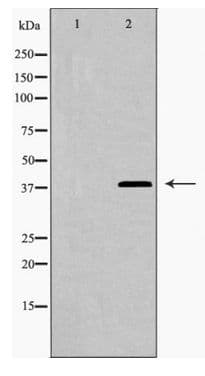 Polyclonal Rabbit anti-Human LGALS9 / Galectin 9 Antibody (IF, WB)