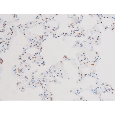 RELA / NFKB p65 Antibody (phospho-Ser281)
