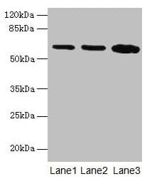 SPTLC2 / LCB2 Antibody (aa88-562)