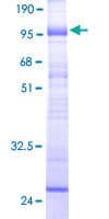 Human SLC22A7 / OAT2 Protein (Recombinant GST)