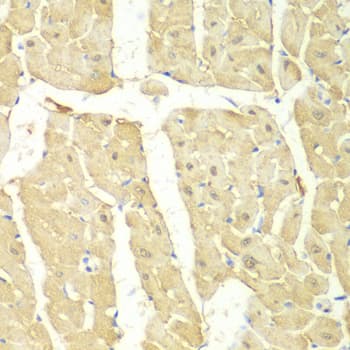 PSMC2 / RPT1 Antibody
