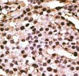 ATG9A Antibody (aa717-746)