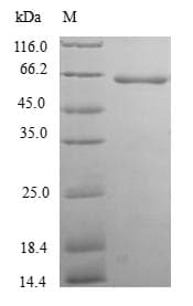 Human TXNDC5 / ERP46 Protein (Recombinant GST, N-terminus)