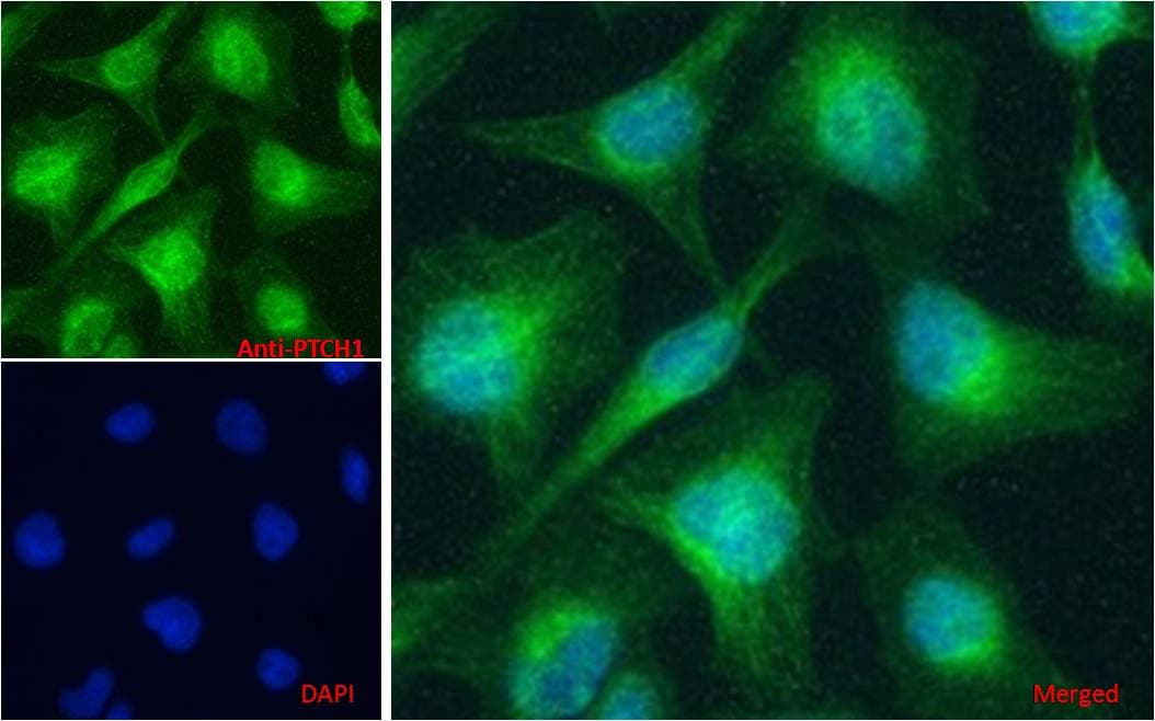Polyclonal Goat anti-Human PTCH1 / Patched 1 Antibody (aa266-280, IF, WB)