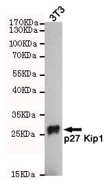CDKN1B / p27 Kip1 Antibody