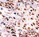 Polyclonal Rabbit anti-Human c-Met Antibody (phospho-Tyr1349, IHC, WB)