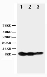 BAFF Receptor / CD268 Antibody (aa1-15)