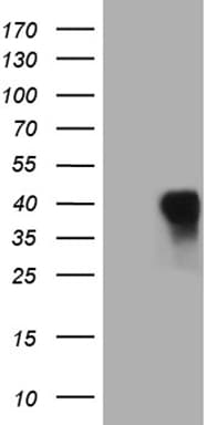 CD79B / CD79 Beta Antibody (clone OTI4E11, Carrier-free)